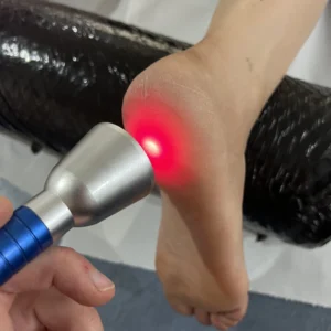 High Intensity Laser Treatment (HILT)
