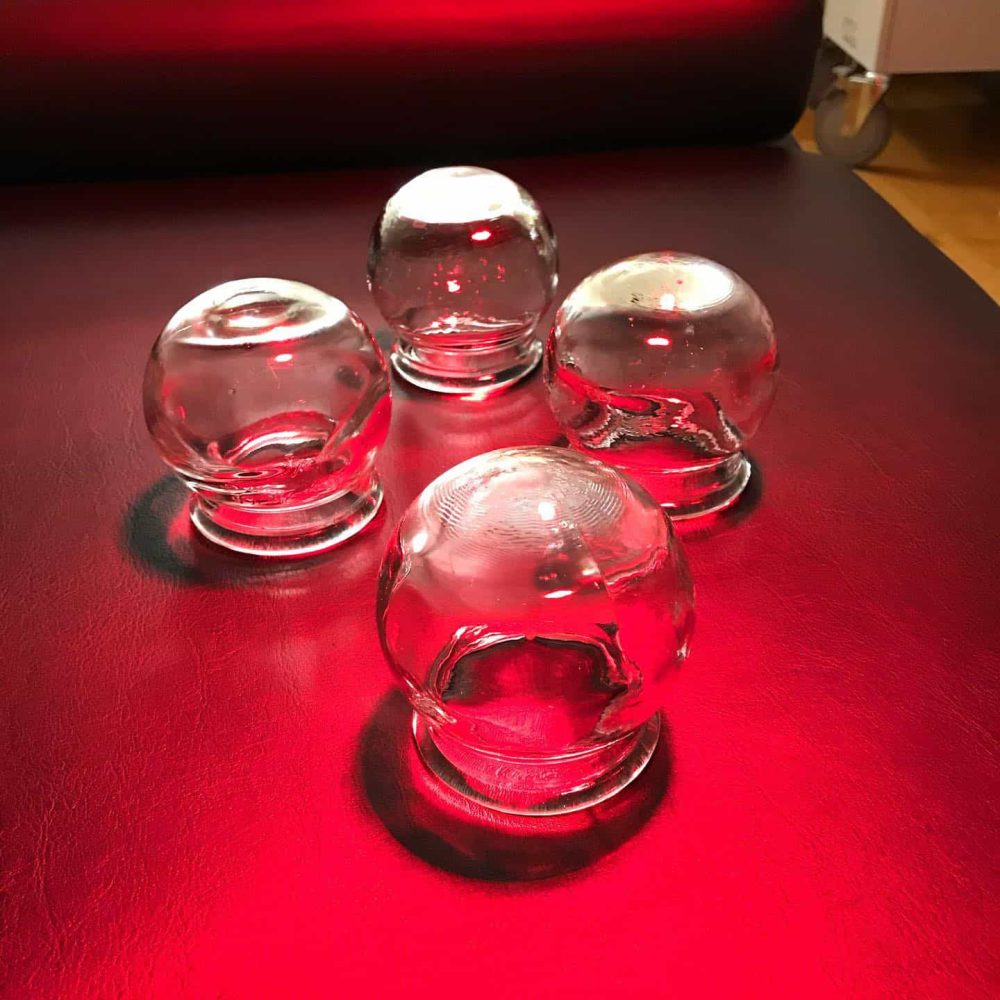 cupping therapy glass cupping jars