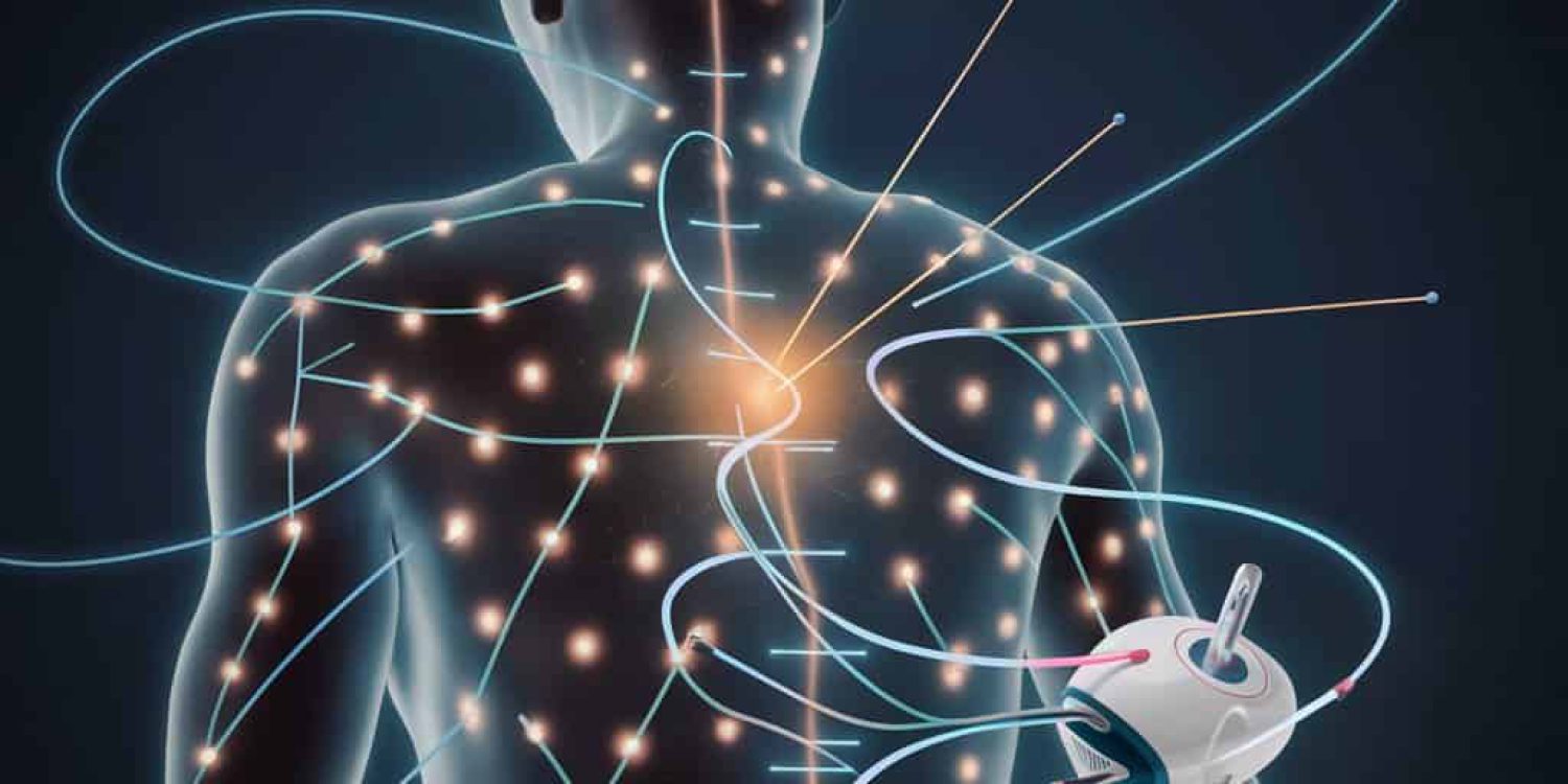 electro therapy on body
